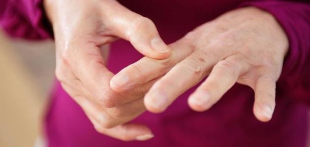 مرض الروماتيزم.. أسبابه وطرق علاجه