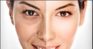 أسباب ظهور الهالات السوداء 