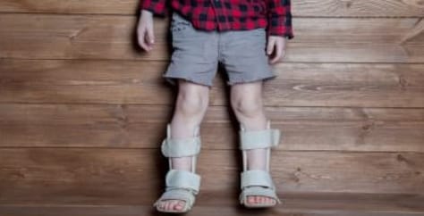 الكساح لدى الأطفال