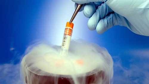 حكم الشرع في تجميد البويضات