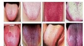 أمراض يكشف عنها لون لسانك أمراض يكشف عنها لون لسانك