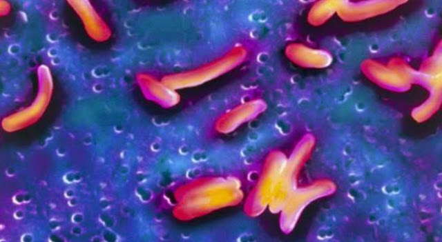 مرض الكوليرا أسبابه وطرق علاجه مرض الكوليرا أسبابه وطرق علاجه