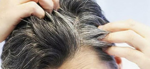 الأطعمة التي تقلل من ظهور الشعر الأبيض