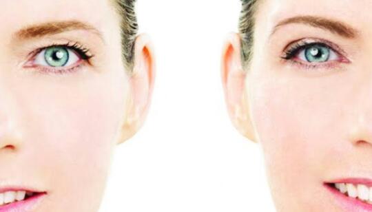 تمارين لشد ترهل الحاجب ورفعه